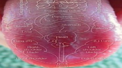 photo of tongue infected with white spots